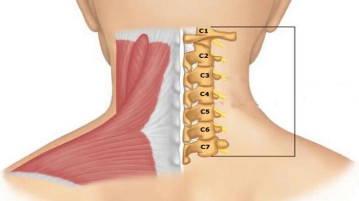 Radicular syndrome manifests itself depending on which vertebra presses on the nerve endings